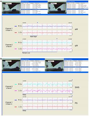Homeostatic Changes in GABA and Glutamate Receptors on Excitatory Cortical Neurons during Sleep Deprivation and Recovery